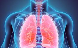 Lung Cancer