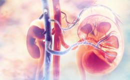 Renal Cell Carcinoma